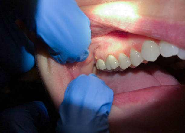 Best Emergency Dental Surgery in Reform, AL